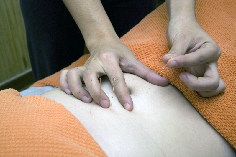 osteopathe-MENTON-min_acupuncture-4175625